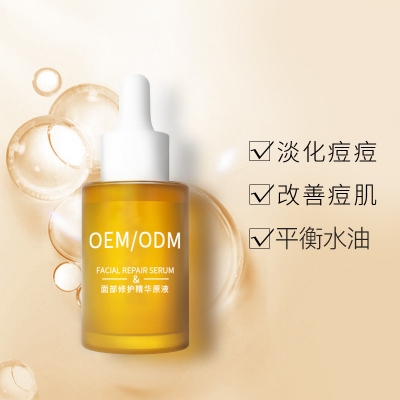 北区_祛痘精华原液OEM